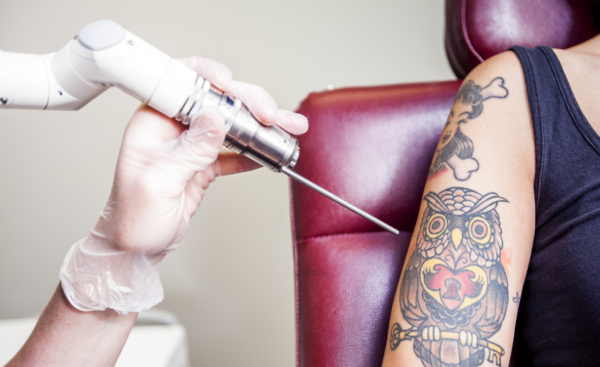 Hyperspectral Imaging Characterizes Spectral Properties of Tattoo Dyes for Optimized Laser Removal